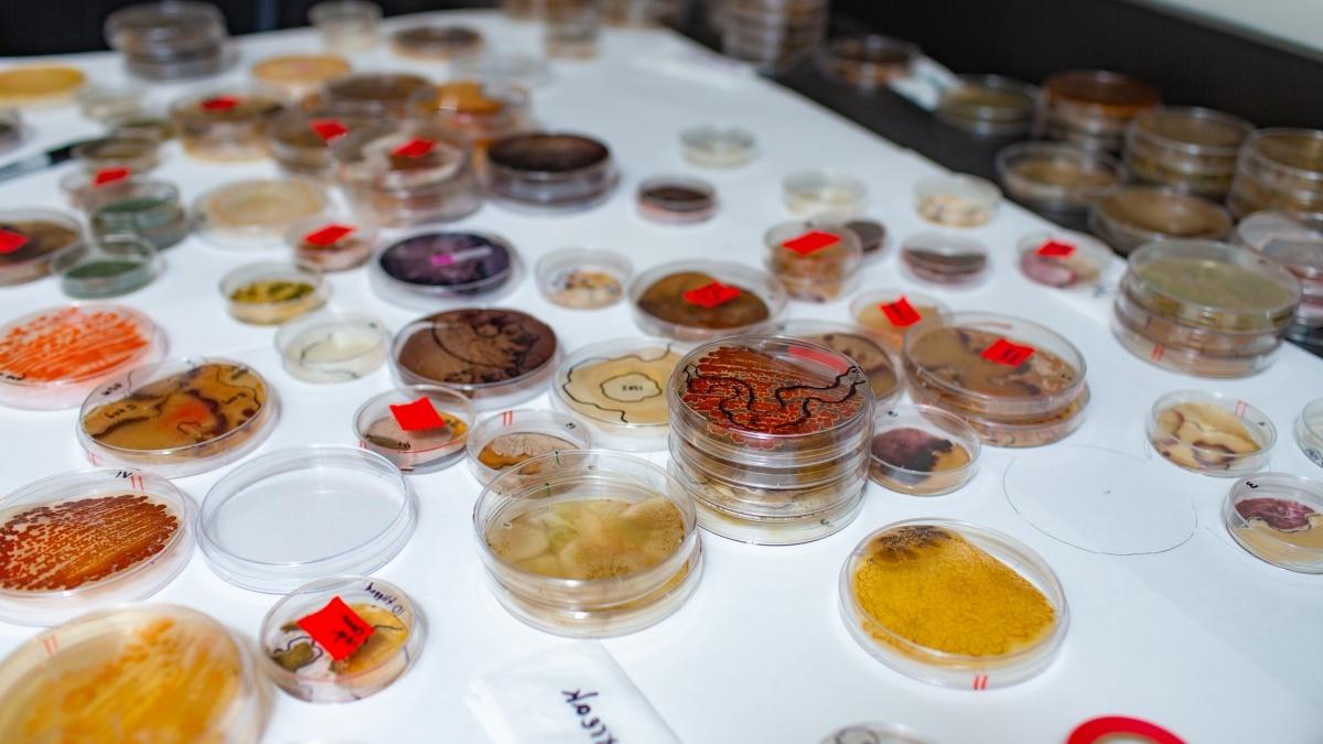 Lab table covered in petri dish samples.